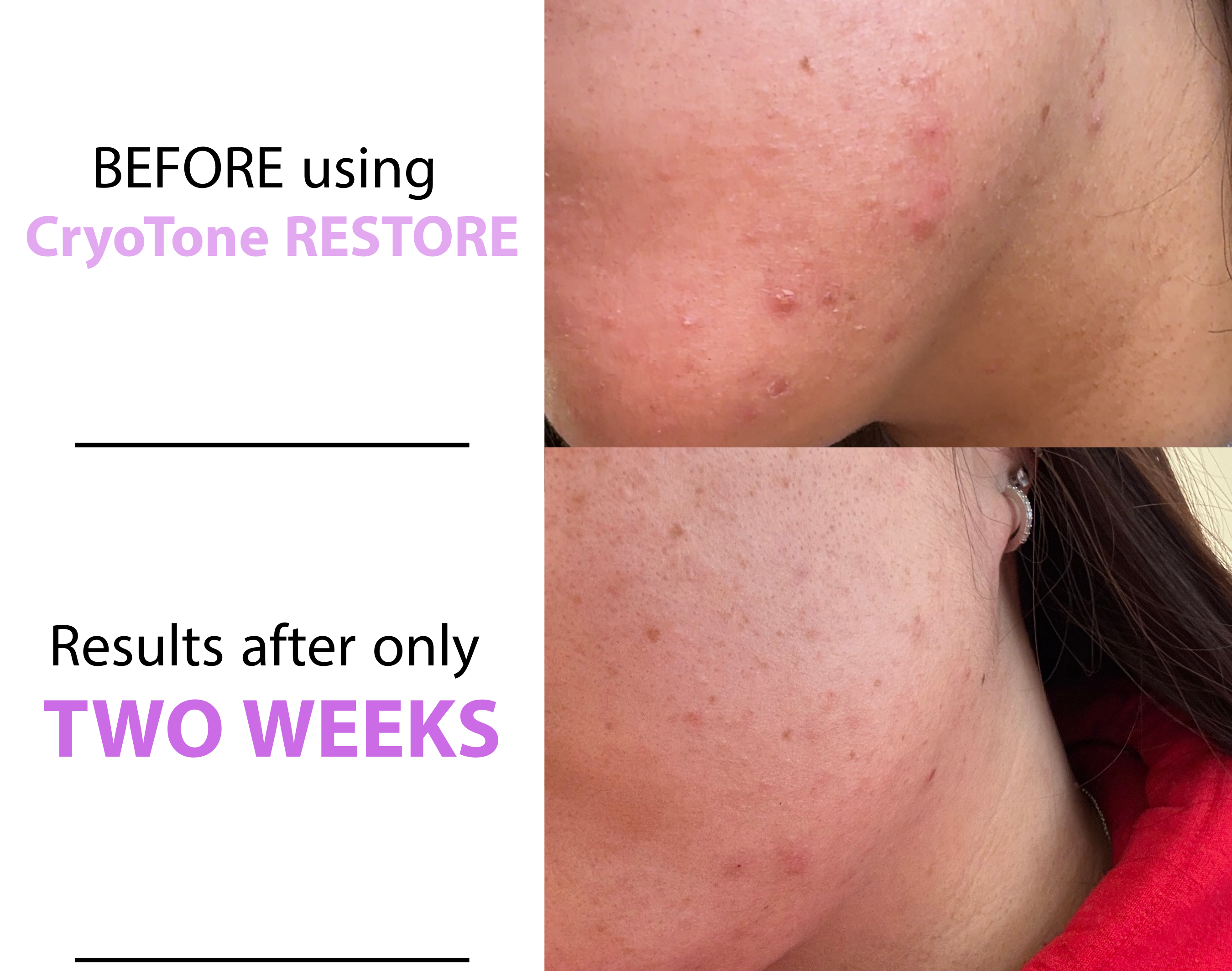CryoTone RESTORE  • Advanced Hydrating Gel (2-Pack)
